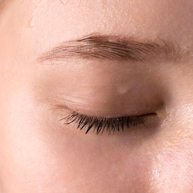 Under Eye Filler | Undereye PRP Haven MD